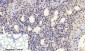 p21 Polyclonal Antibody